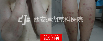 400-160-前.jpg