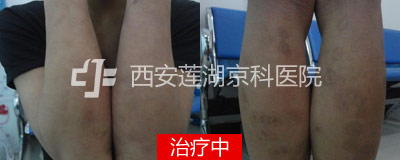 400-160-中.jpg