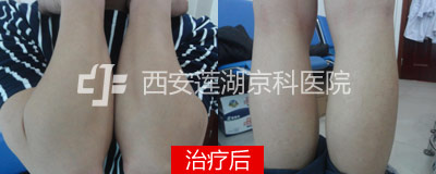400-160-后.jpg