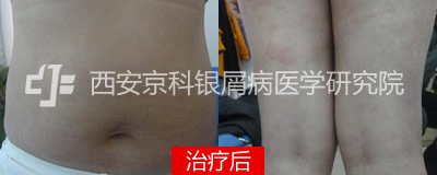 400-160-后.jpg