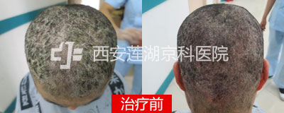 400-160-前.jpg