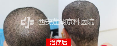 400-160-前.jpg