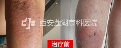 400-160-前.jpg