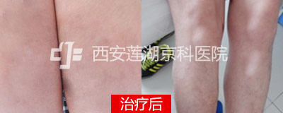 400-160-后.jpg